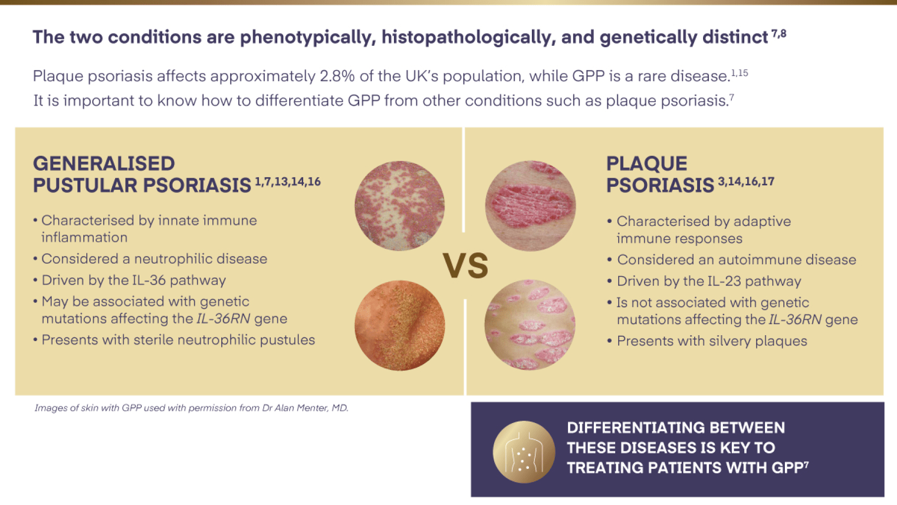 GPP is not plaque psoriasis.