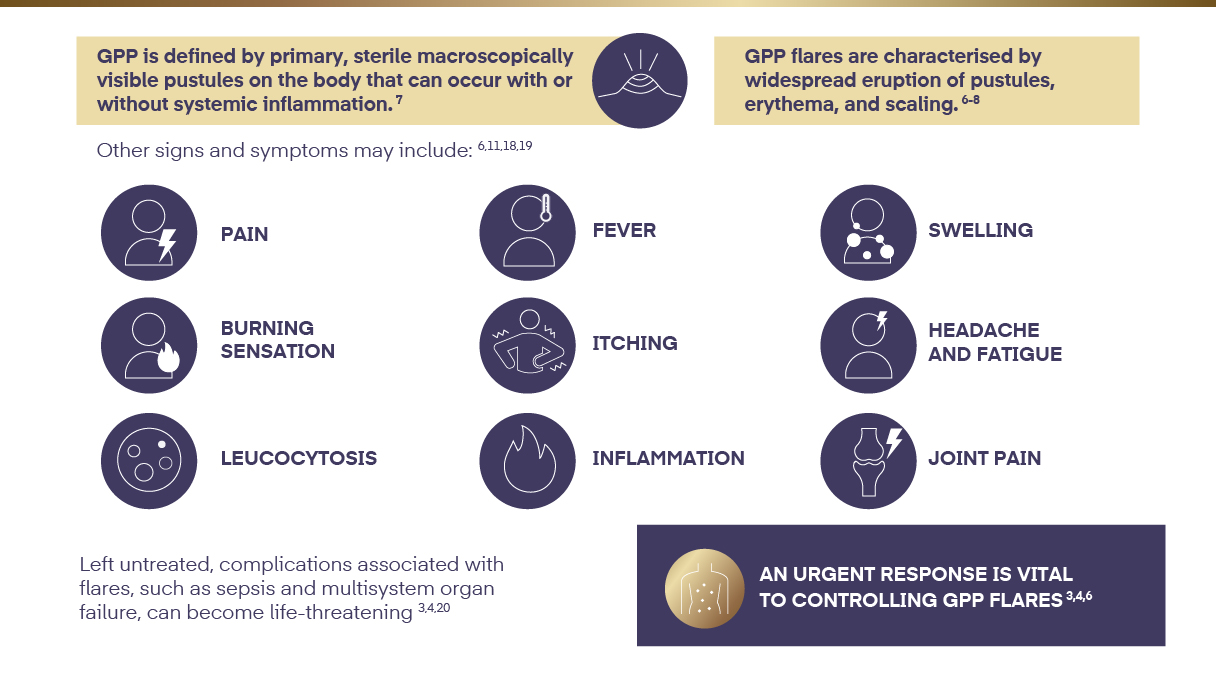 GPP has distinct characteristics