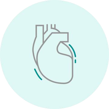 Peripheral Artery Disease