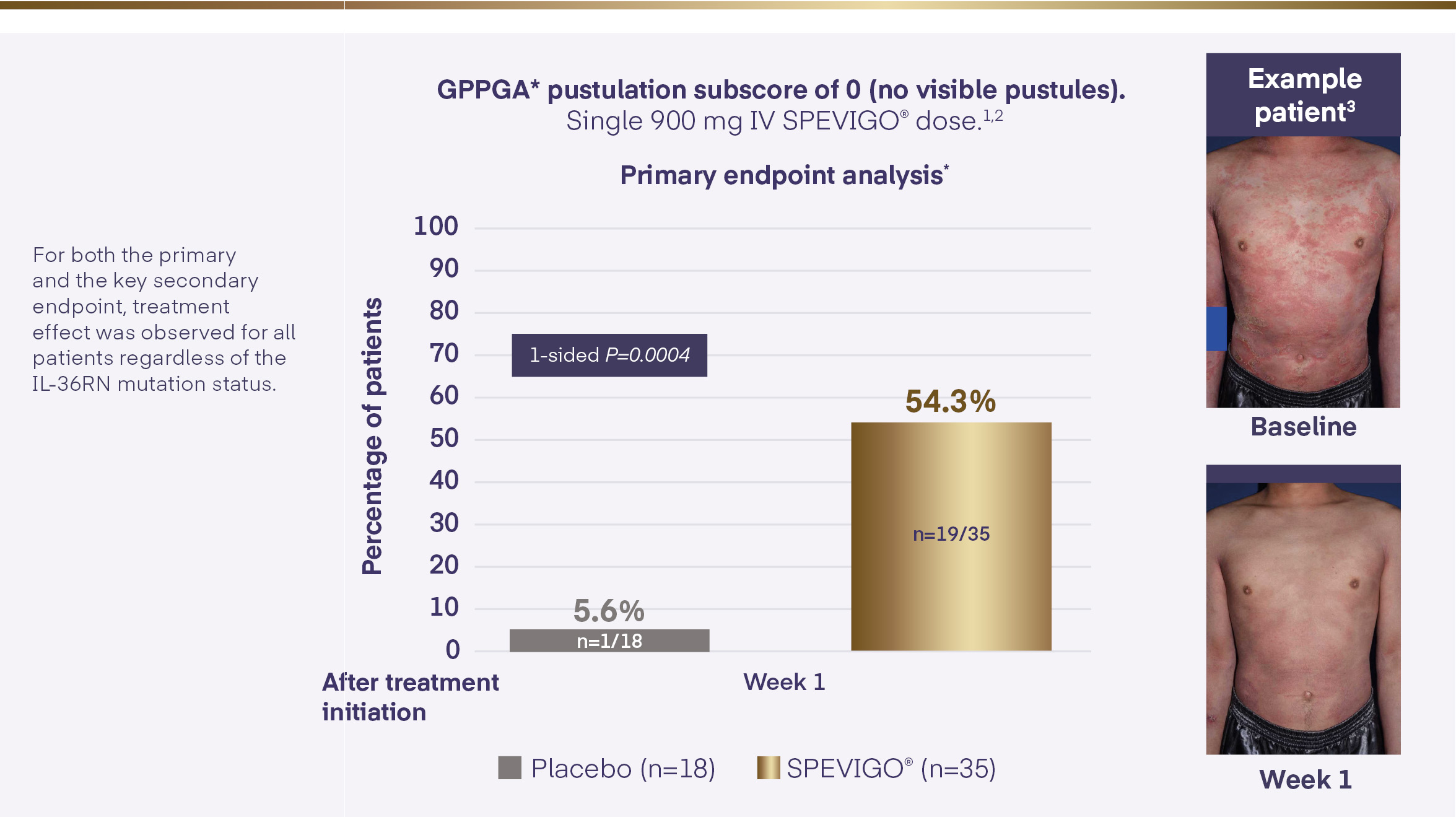 With SPEVIGO®, 54.3% of patients achieved complete pustular clearance at Week 1.