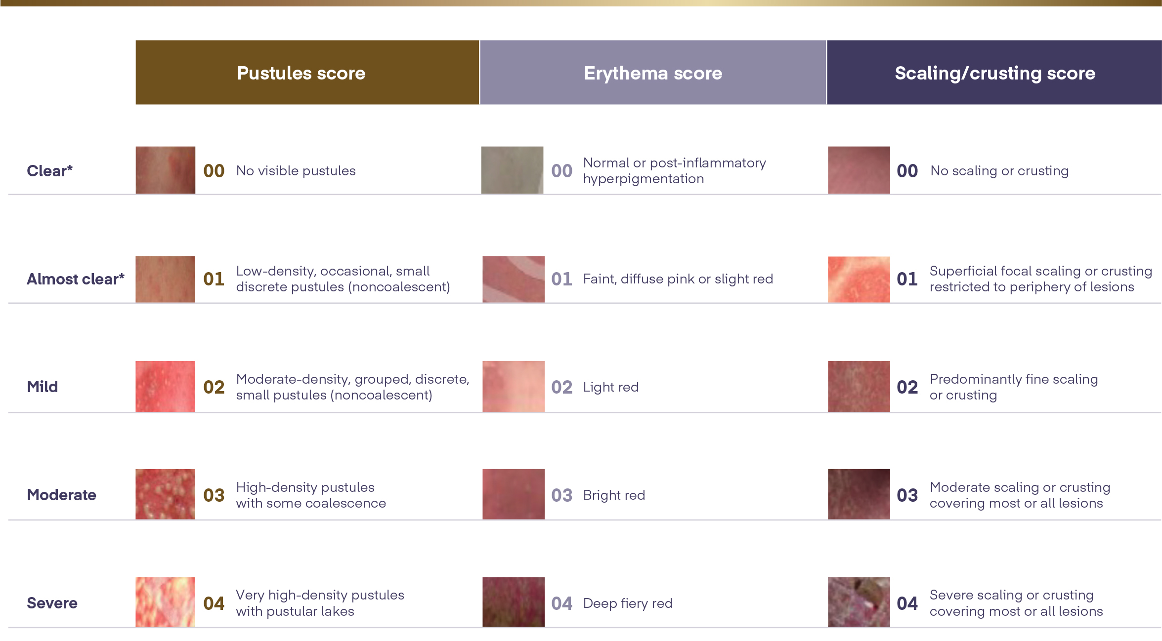 Flare control scoreboard.
