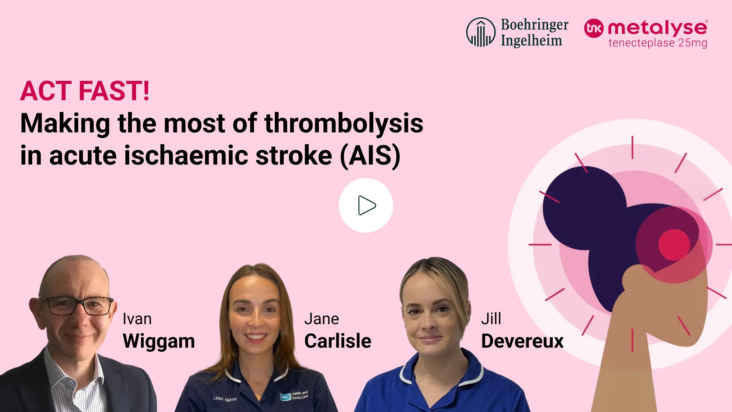 Time is brain webinar thumbnail